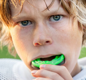 sports mouthguard