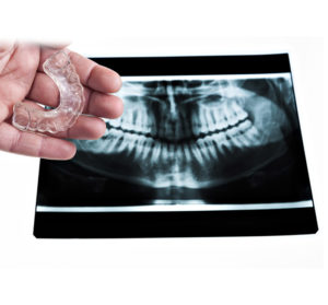 dental radiographs (x-rays)
