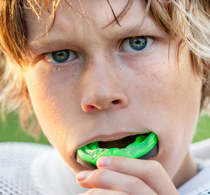 Custom Mouthguards Croydon