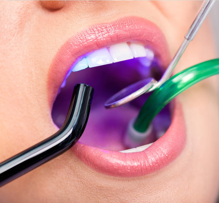 Croydon family dentist - Best for kids' teeth
