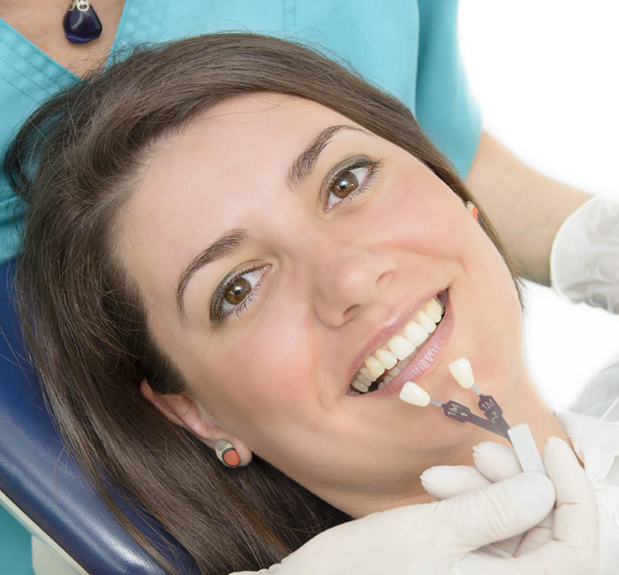 Veneers-img