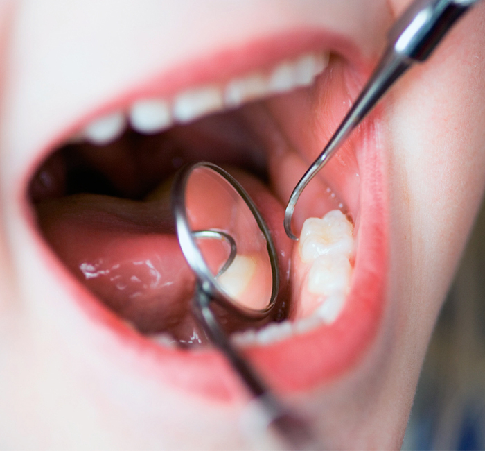 MOUTH-img