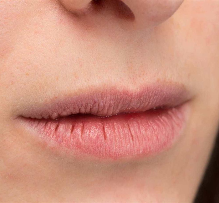 dry-mouth-img