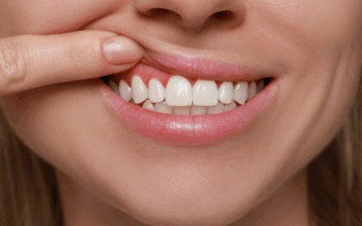 The Importance of Healthy Gums: Preventing Gum Disease Early